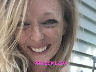 Xfreckledx